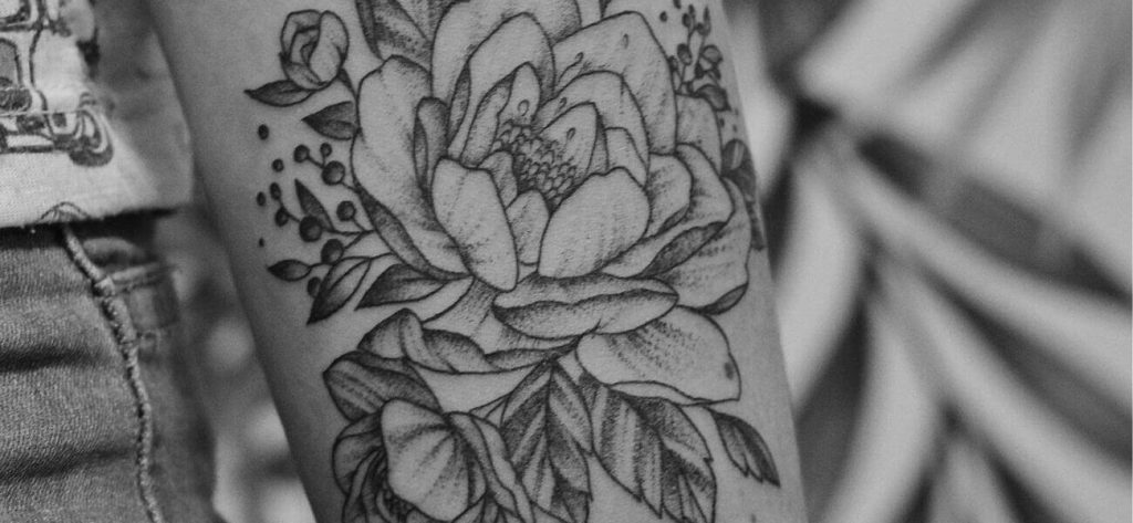 Een tatoeage laten verwijderen